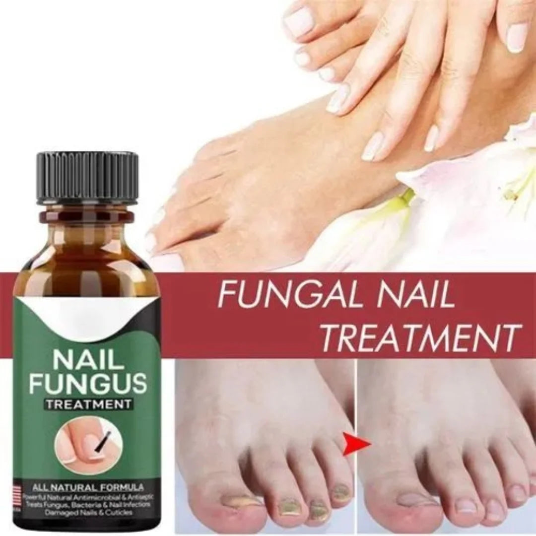 7 days Nail Treatment,Nail Serum & Cuticle Care Oil (Pack of 2)