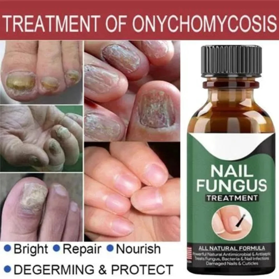 7 days Nail Treatment,Nail Serum & Cuticle Care Oil (Pack of 2)